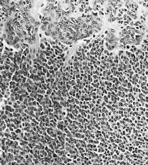 Ein schwarz-weißes mikroskopisches Bild einer kleinen Zellgruppe, die mit Anti-PFA1-Antikörper und BSA gefärbt ist.